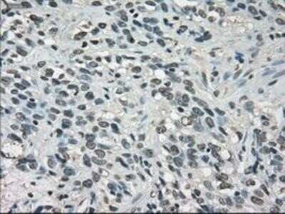 Immunohistochemistry: Lactate Dehydrogenase A/LDHA Antibody (OTI2D11) - Azide and BSA Free [NBP2-71121]