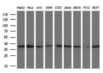 Western Blot: Lactate Dehydrogenase A/LDHA Antibody (OTI2D11)Azide and BSA Free [NBP2-71121]