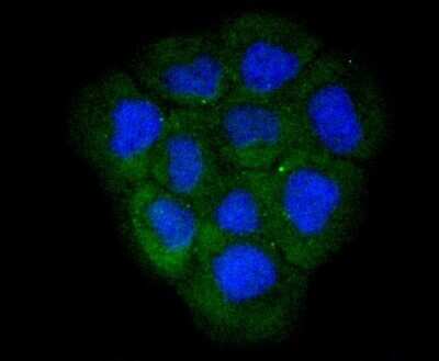 Immunocytochemistry/ Immunofluorescence: Lactate Dehydrogenase A/LDHA Antibody (SU39-06) [NBP2-67483]