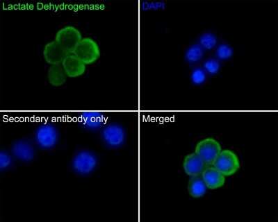 Immunocytochemistry/ Immunofluorescence: Lactate Dehydrogenase A/LDHA Antibody (SU39-06) [NBP2-67483]