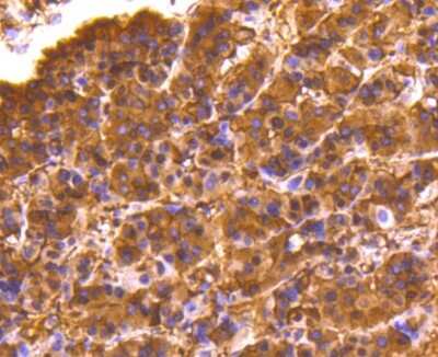 Immunohistochemistry-Paraffin: Lactate Dehydrogenase A/LDHA Antibody (SU39-06) [NBP2-67483]