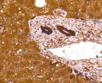 Immunohistochemistry-Paraffin: Lactate Dehydrogenase A/LDHA Antibody (SU39-06) [NBP2-67483]