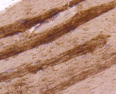 Immunohistochemistry-Paraffin: Lactate Dehydrogenase A/LDHA Antibody (SU39-06) [NBP2-67483]