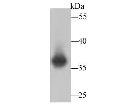 Western Blot: Lactate Dehydrogenase A/LDHA Antibody (SU39-06) [NBP2-67483]
