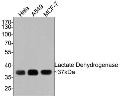 Western Blot: Lactate Dehydrogenase A/LDHA Antibody (SU39-06) [NBP2-67483]