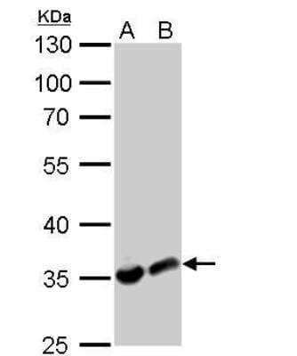 Western Blot: Lactate Dehydrogenase A/LDHA Antibody [NBP2-19320]