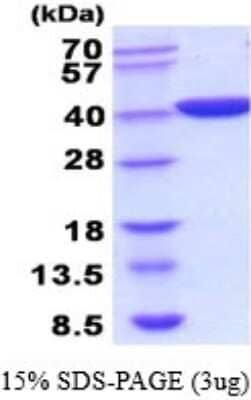 SDS-PAGE: Recombinant E. coli Lactate Dehydrogenase A/LDHA His Protein [NBP2-52236]