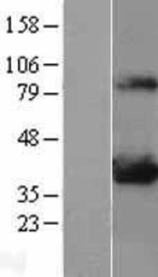 Western Blot: Lactate Dehydrogenase A/LDHA Overexpression Lysate [NBL1-12470]