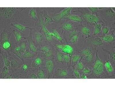 Immunocytochemistry/ Immunofluorescence: Lactate Dehydrogenase Antibody [NB600-861]