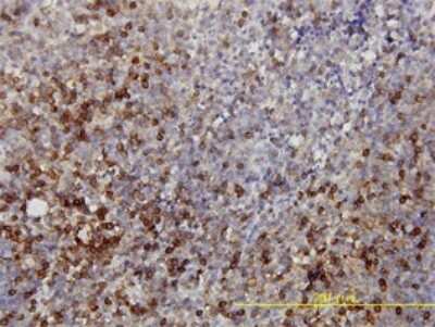 Immunohistochemistry-Paraffin: Lactate Dehydrogenase B Antibody (2H6) [H00003945-M01]