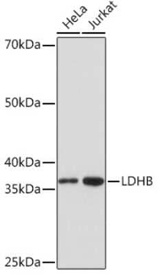 Western Blot: Lactate Dehydrogenase B Antibody (6B5I2) [NBP3-16569]