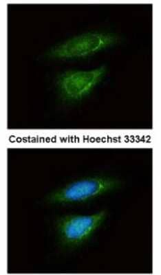 Immunocytochemistry/ Immunofluorescence: Lactate Dehydrogenase B Antibody [NBP1-31945]