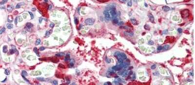 Immunohistochemistry: Lactate Dehydrogenase B Antibody [NBP1-55415]