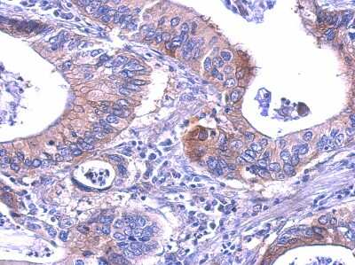 Immunohistochemistry-Paraffin: Lactate Dehydrogenase B Antibody [NBP1-31945]