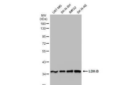 Western Blot: Lactate Dehydrogenase B Antibody [NBP1-31945]