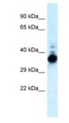 Western Blot: Lactate Dehydrogenase B Antibody [NBP1-55415]