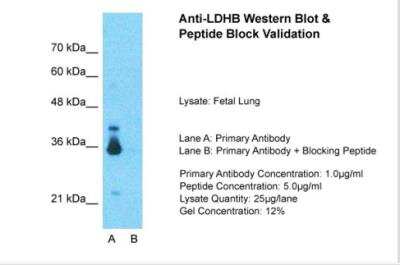 Western Blot: Lactate Dehydrogenase B Antibody [NBP1-55415]