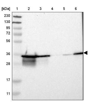 Western Blot: Lactate Dehydrogenase B Antibody [NBP2-38131]