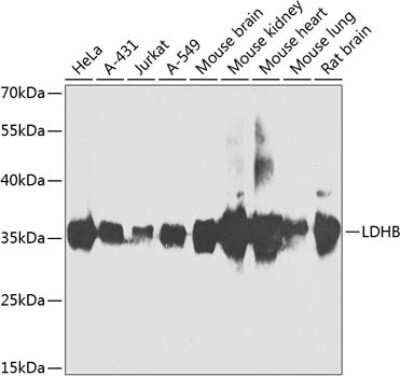 Western Blot: Lactate Dehydrogenase B AntibodyBSA Free [NBP3-03453]