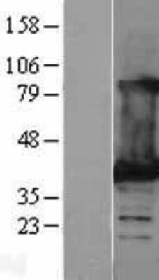 Western Blot: Lactate Dehydrogenase B Overexpression Lysate [NBL1-12472]