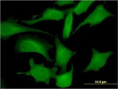 Immunocytochemistry/ Immunofluorescence: Lactate Dehydrogenase C Antibody (2C8) [H00003948-M01]