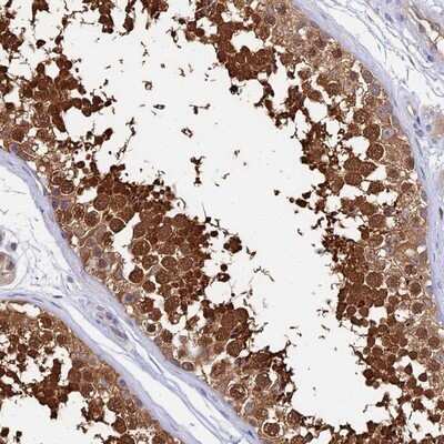 Immunohistochemistry-Paraffin: Lactate Dehydrogenase C Antibody [NBP1-92065]