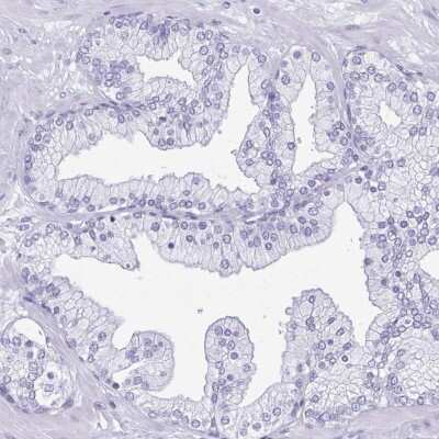 Immunohistochemistry-Paraffin: Lactate Dehydrogenase C Antibody [NBP1-92065]