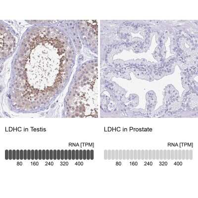 Immunohistochemistry-Paraffin: Lactate Dehydrogenase C Antibody [NBP1-92065]