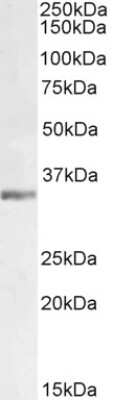 Western Blot: Lactate Dehydrogenase C Antibody [NB100-68160]