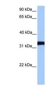 Western Blot: Lactate Dehydrogenase C Antibody [NBP1-54798]