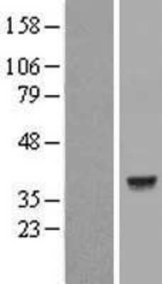 Western Blot: Lactate Dehydrogenase C Overexpression Lysate [NBL1-12474]