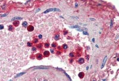 Immunohistochemistry-Paraffin: Lactoferrin Antibody [NBP1-05027]