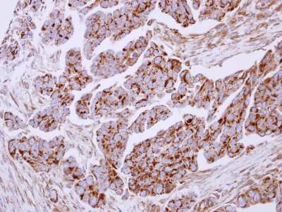 Immunohistochemistry-Paraffin: Lactoferrin Antibody [NBP2-19322]
