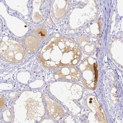 Immunohistochemistry-Paraffin: Lactoferrin Antibody [NBP2-38823]