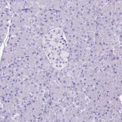 Immunohistochemistry-Paraffin: Lactoferrin Antibody [NBP2-38823]