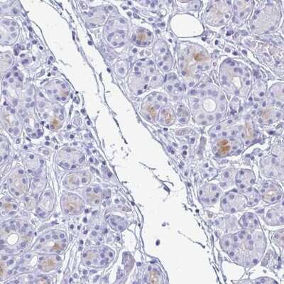 Immunohistochemistry-Paraffin: Lactoferrin Antibody [NBP2-38823]
