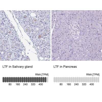 Immunohistochemistry-Paraffin: Lactoferrin Antibody [NBP2-38823]