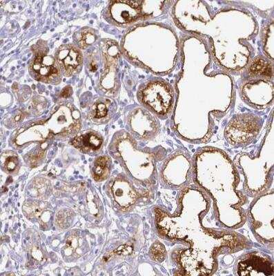 Immunohistochemistry-Paraffin: Lactoferrin Antibody [NBP2-38885]
