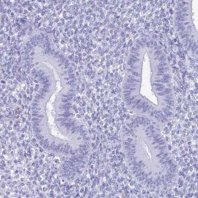Immunohistochemistry-Paraffin: Lactoferrin Antibody [NBP2-38885]