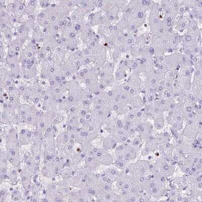 Immunohistochemistry-Paraffin: Lactoferrin Antibody [NBP2-38885]