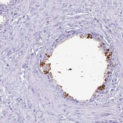 Immunohistochemistry-Paraffin: Lactoferrin Antibody [NBP2-38885]