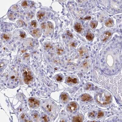 Immunohistochemistry-Paraffin: Lactoferrin Antibody [NBP2-38885]