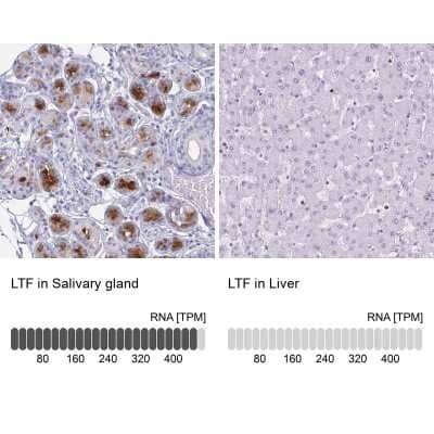 Immunohistochemistry-Paraffin: Lactoferrin Antibody [NBP2-38885]