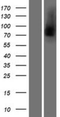 Western Blot: Lactoferrin Overexpression Lysate [NBP2-10824]