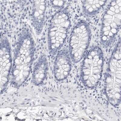 Immunohistochemistry-Paraffin: Lactoperoxidase Antibody [NBP1-87010]