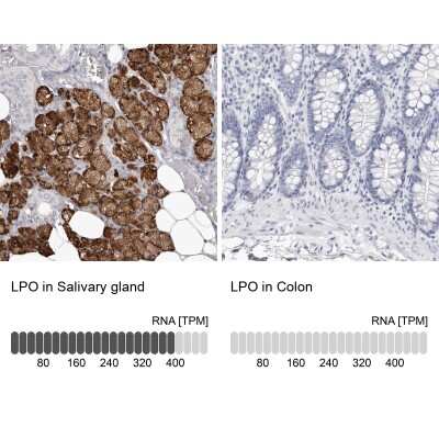 Immunohistochemistry-Paraffin: Lactoperoxidase Antibody [NBP1-87010]
