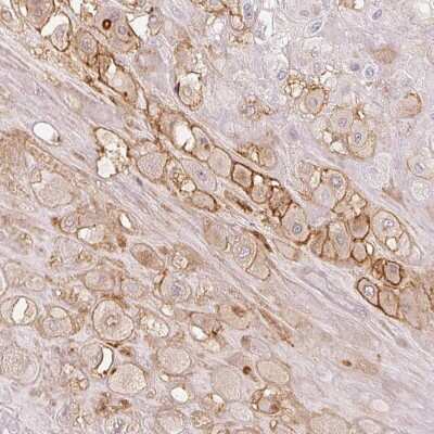 Immunohistochemistry-Paraffin: Laeverin Antibody [NBP2-47404]