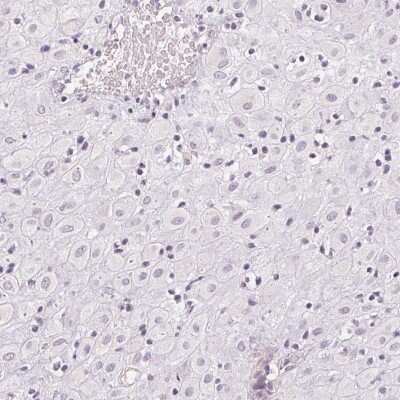 Immunohistochemistry-Paraffin: Laeverin Antibody [NBP2-47404]