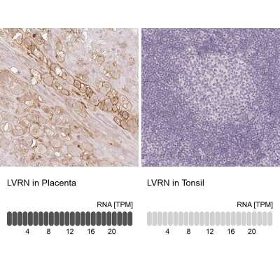 Immunohistochemistry-Paraffin: Laeverin Antibody [NBP2-47404]