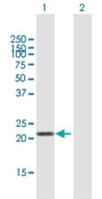 Western Blot: Laeverin Antibody [H00206338-B01P]